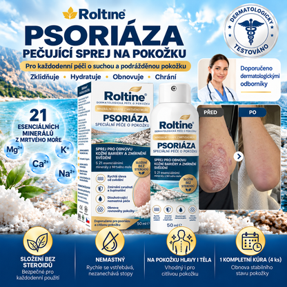 🎁💧 Roltine® Speciální krém pro péči o pokožku s lupénkou – ✅ Dermatologicky testováno