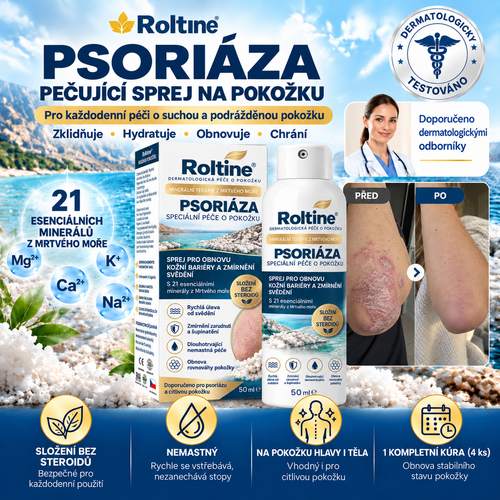 🎁💧 Roltine® Speciální krém pro péči o pokožku s lupénkou – ✅ Dermatologicky testováno