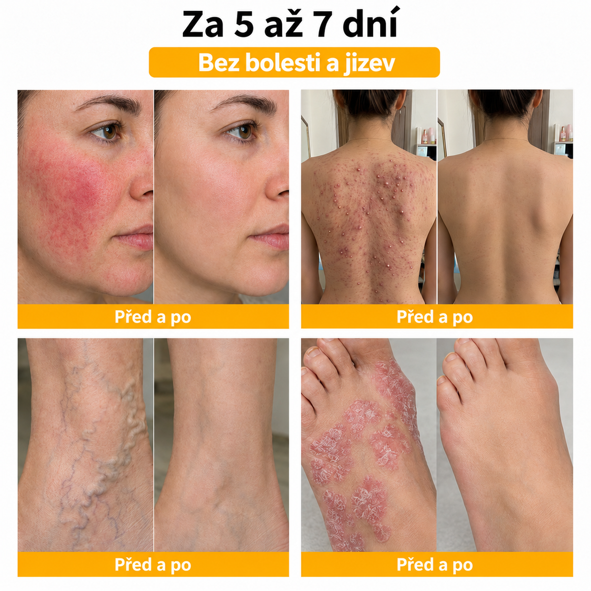 🐝 Roltine®: Pokročilá péče se včelím jedem proti bradavicím a kožním nedokonalostem 👨‍⚕️ Inspirováno dermatologickou vědou | Cílená péče v pohodlí domova