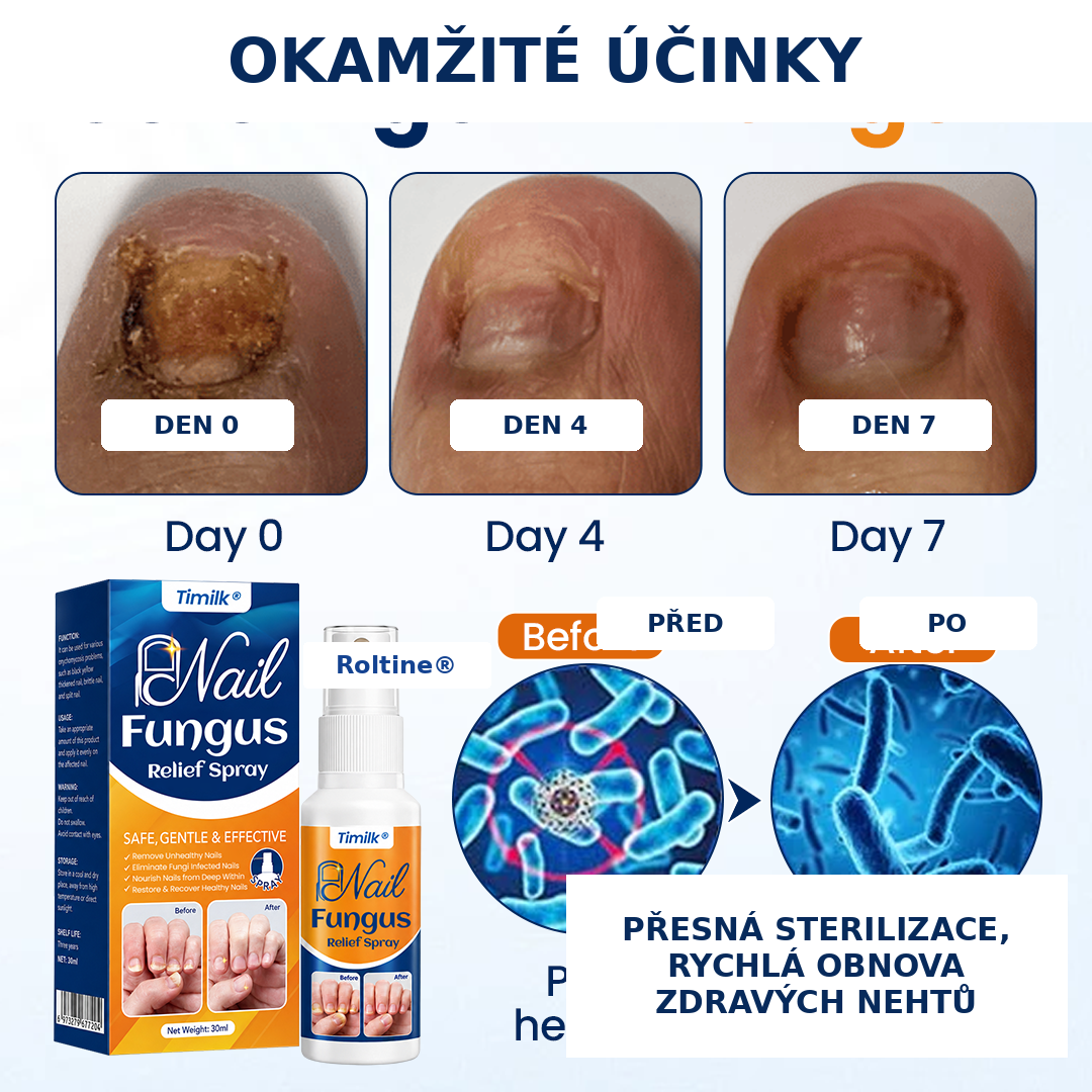 Roltine® Sprej proti plísním nehtů