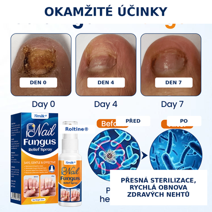 Roltine® Sprej proti plísním nehtů