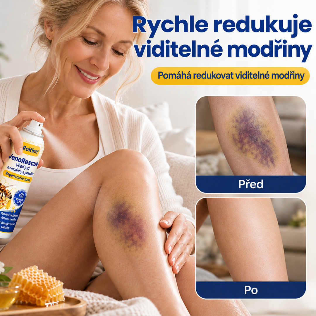 Roltine® VenoRescue – sprej s včelím jedem na modřiny a regeneraci pokožky