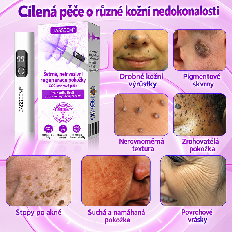𝐉𝐚𝐬𝐬𝐞𝐞𝐦® Pokročilé neinvazivní CO₂ laserové pero pro zdokonalení pokožky 🎉 (Šetrně odstraňuje bradavice, znaménka, stařecké skvrny a kožní výrůstky – bez bolesti a zbytečných starostí!)