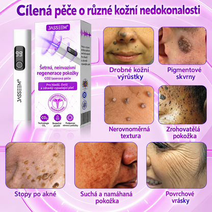 𝐉𝐚𝐬𝐬𝐞𝐞𝐦® Pokročilé neinvazivní CO₂ laserové pero pro zdokonalení pokožky 🎉 (Šetrně odstraňuje bradavice, znaménka, stařecké skvrny a kožní výrůstky – bez bolesti a zbytečných starostí!)