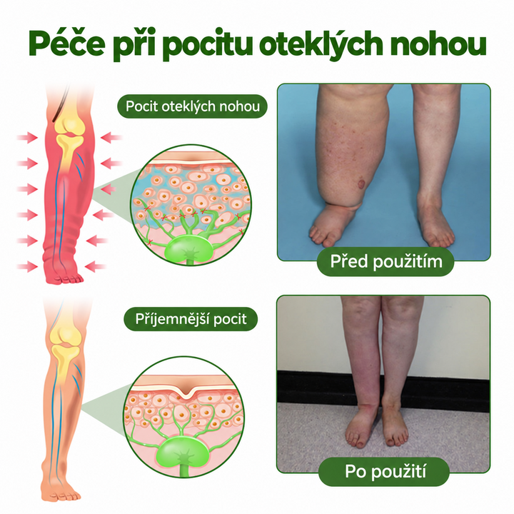 Timilk® Professional Krém na prokrvení nohou