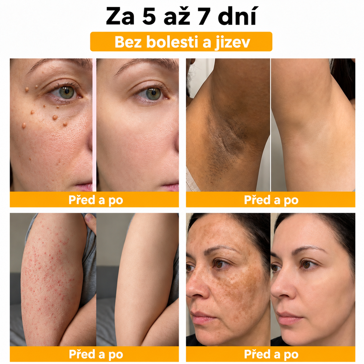 🐝 Roltine®: Pokročilá péče se včelím jedem proti bradavicím a kožním nedokonalostem 👨‍⚕️ Inspirováno dermatologickou vědou | Cílená péče v pohodlí domova
