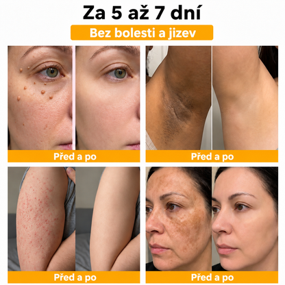 🐝 Roltine®: Pokročilá péče se včelím jedem proti bradavicím a kožním nedokonalostem 👨‍⚕️ Inspirováno dermatologickou vědou | Cílená péče v pohodlí domova