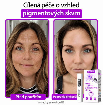 𝐉𝐚𝐬𝐬𝐞𝐞𝐦® Pokročilé neinvazivní CO₂ laserové pero pro zdokonalení pokožky 🎉 (Šetrně odstraňuje bradavice, znaménka, stařecké skvrny a kožní výrůstky – bez bolesti a zbytečných starostí!)