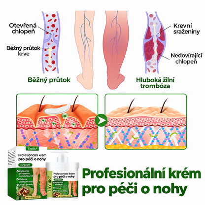 Timilk® Professional Krém na prokrvení nohou