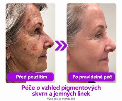 𝐉𝐚𝐬𝐬𝐞𝐞𝐦® Pokročilé neinvazivní CO₂ laserové pero pro zdokonalení pokožky 🎉 (Šetrně odstraňuje bradavice, znaménka, stařecké skvrny a kožní výrůstky – bez bolesti a zbytečných starostí!)