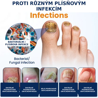 Roltine® Sprej proti plísním nehtů