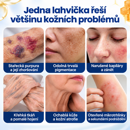 Roltine® VenoRescue – sprej s včelím jedem na modřiny a regeneraci pokožky