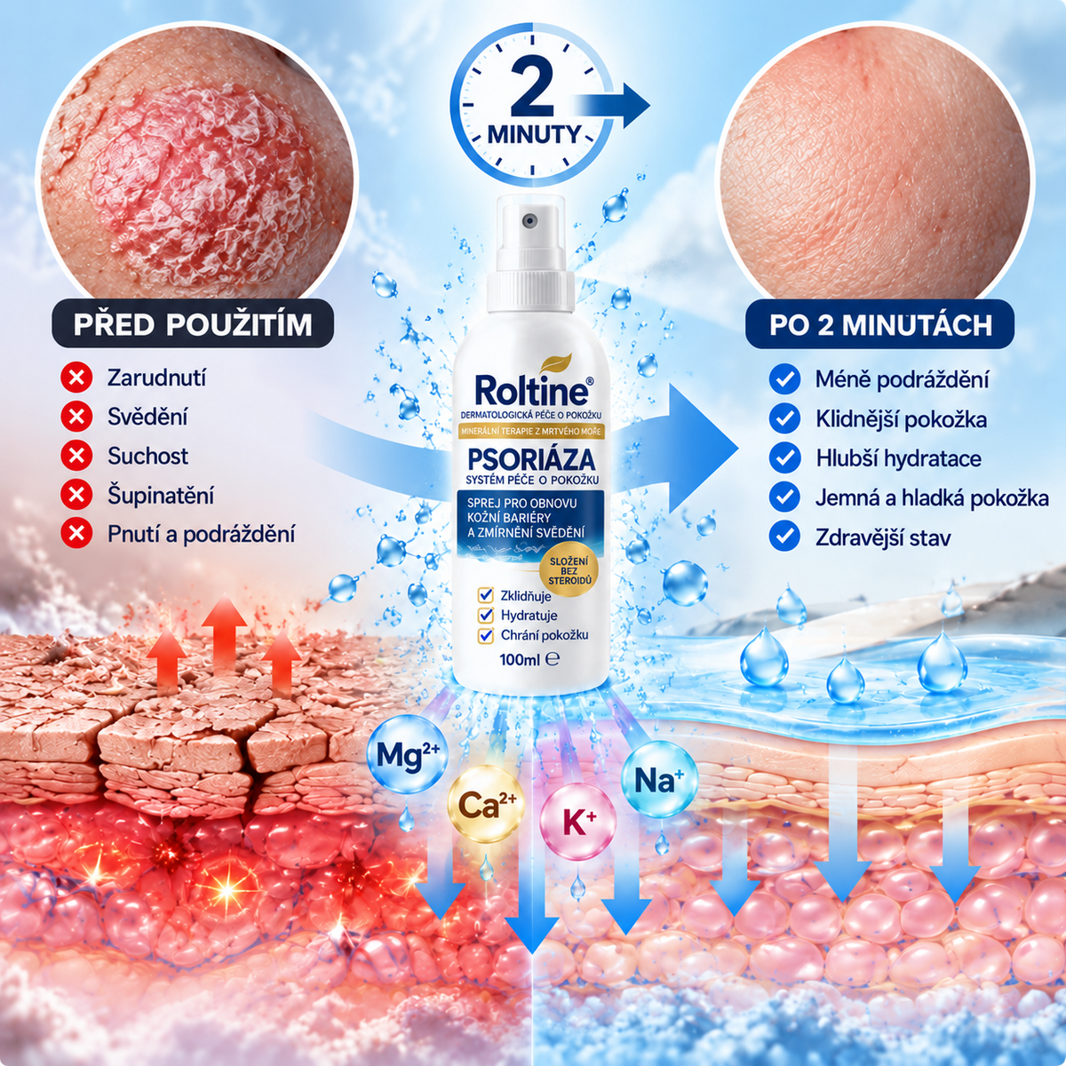 🎁💧 Roltine® Speciální krém pro péči o pokožku s lupénkou – ✅ Dermatologicky testováno