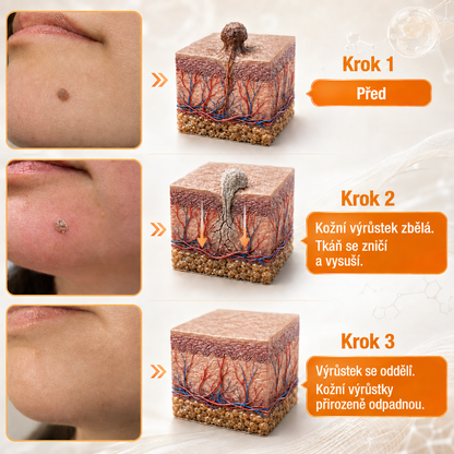 🐝 Roltine®: Pokročilá péče se včelím jedem proti bradavicím a kožním nedokonalostem 👨‍⚕️ Inspirováno dermatologickou vědou | Cílená péče v pohodlí domova