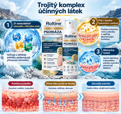🎁💧 Roltine® Speciální krém pro péči o pokožku s lupénkou – ✅ Dermatologicky testováno