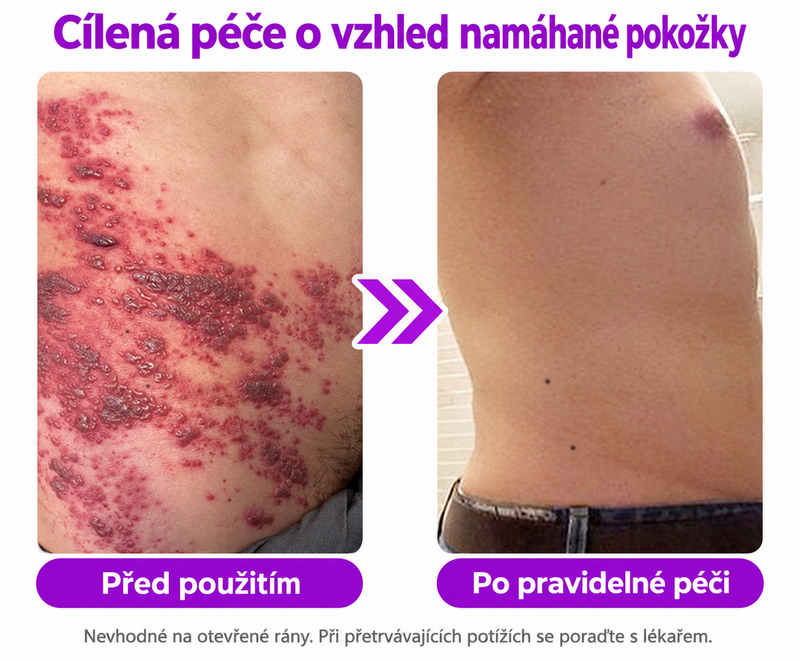 𝐉𝐚𝐬𝐬𝐞𝐞𝐦® Pokročilé neinvazivní CO₂ laserové pero pro zdokonalení pokožky 🎉 (Šetrně odstraňuje bradavice, znaménka, stařecké skvrny a kožní výrůstky – bez bolesti a zbytečných starostí!)