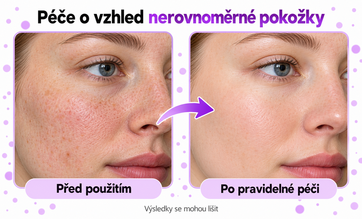 𝐉𝐚𝐬𝐬𝐞𝐞𝐦® Pokročilé neinvazivní CO₂ laserové pero pro zdokonalení pokožky 🎉 (Šetrně odstraňuje bradavice, znaménka, stařecké skvrny a kožní výrůstky – bez bolesti a zbytečných starostí!)