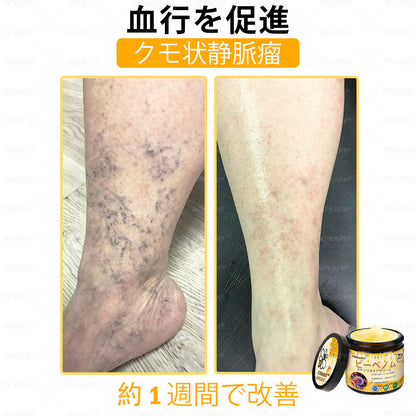 ✨APKAPK® 𝗠É𝗛𝗠É𝗥𝗘𝗚 総合クリーム🥇 皮膚の隆起に対するケアには以下が含まれます： 加齢によるシミ、傷跡、いぼ、皮膚の隆起、脂肪の塊、ニキビ、湿疹、乾癬、反転性ニキビ、しわ、皮膚の老化およびその他の問題🔥