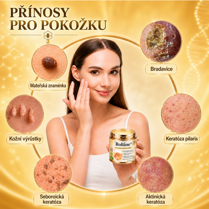 🐝 Roltine®: Pokročilá péče se včelím jedem proti bradavicím a kožním nedokonalostem 👨‍⚕️ Inspirováno dermatologickou vědou | Cílená péče v pohodlí domova