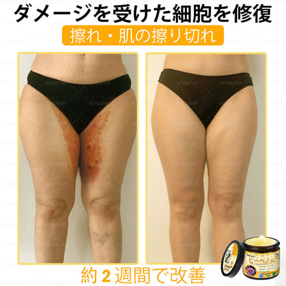 ✨APKAPK® 𝗠É𝗛𝗠É𝗥𝗘𝗚 総合クリーム🥇 皮膚の隆起に対するケアには以下が含まれます： 加齢によるシミ、傷跡、いぼ、皮膚の隆起、脂肪の塊、ニキビ、湿疹、乾癬、反転性ニキビ、しわ、皮膚の老化およびその他の問題🔥