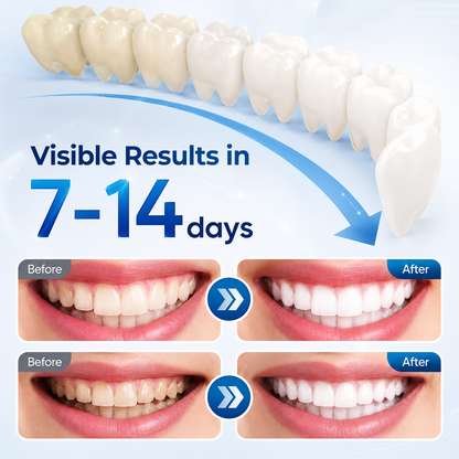 Mresio® RegenDent Advanced Tooth & Gum Renewal Device
