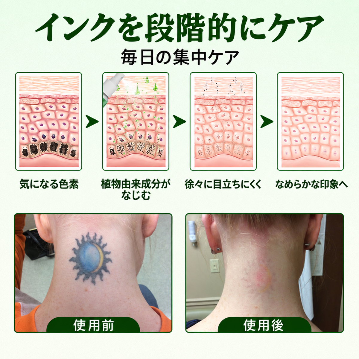 Micdtry® PureAlgae タトゥー除去サポートスプレーB - 古いタトゥーの色素にさよなら、頑固なインクを薄くし、施術後の肌を修復・滑らかに - レーザー不要、今すぐお試しください！✨