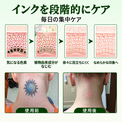 Micdtry® PureAlgae タトゥー除去サポートスプレーB - 古いタトゥーの色素にさよなら、頑固なインクを薄くし、施術後の肌を修復・滑らかに - レーザー不要、今すぐお試しください！✨