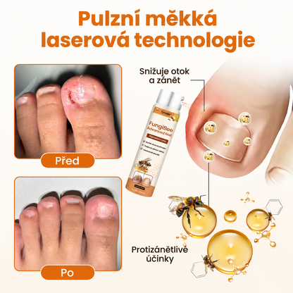 Timilk® FungiBee Advanced – Regenerační sprej pro oslabené nehty📦