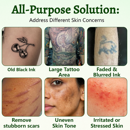 Ceoerty PureAlgae InkRemoval Support SprayB -Say Goodbye to oldTattoo PigmentM,FadeStubborn Ink $, Repair &Smooth Treated Skin-Non-Laser, Try It Now!