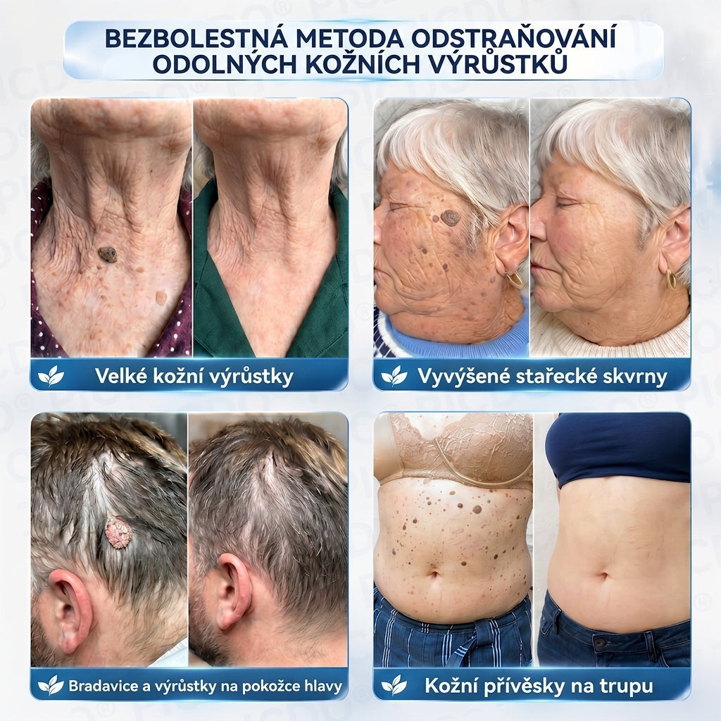 APKAPK® 𝟕𝐝𝐞𝐧𝐧í 𝐤𝐫é𝐦 𝐩𝐫𝐨𝐭𝐢 𝐤𝐨ž𝐧í𝐦 𝐯𝐲𝐫ů𝐬𝐭𝐤ů𝐦 𝐚 𝐩𝐢𝐠𝐦𝐞𝐧𝐭𝐨𝐯ý𝐦 𝐬𝐤𝐯𝐫𝐧á𝐦 (𝐁𝐞𝐳𝐛𝐨𝐥𝐞𝐬𝐭𝐧á 𝐟𝐨𝐫𝐦𝐮𝐥𝐞 – 𝐛𝐞𝐳 𝐣𝐢𝐳𝐞𝐯)
