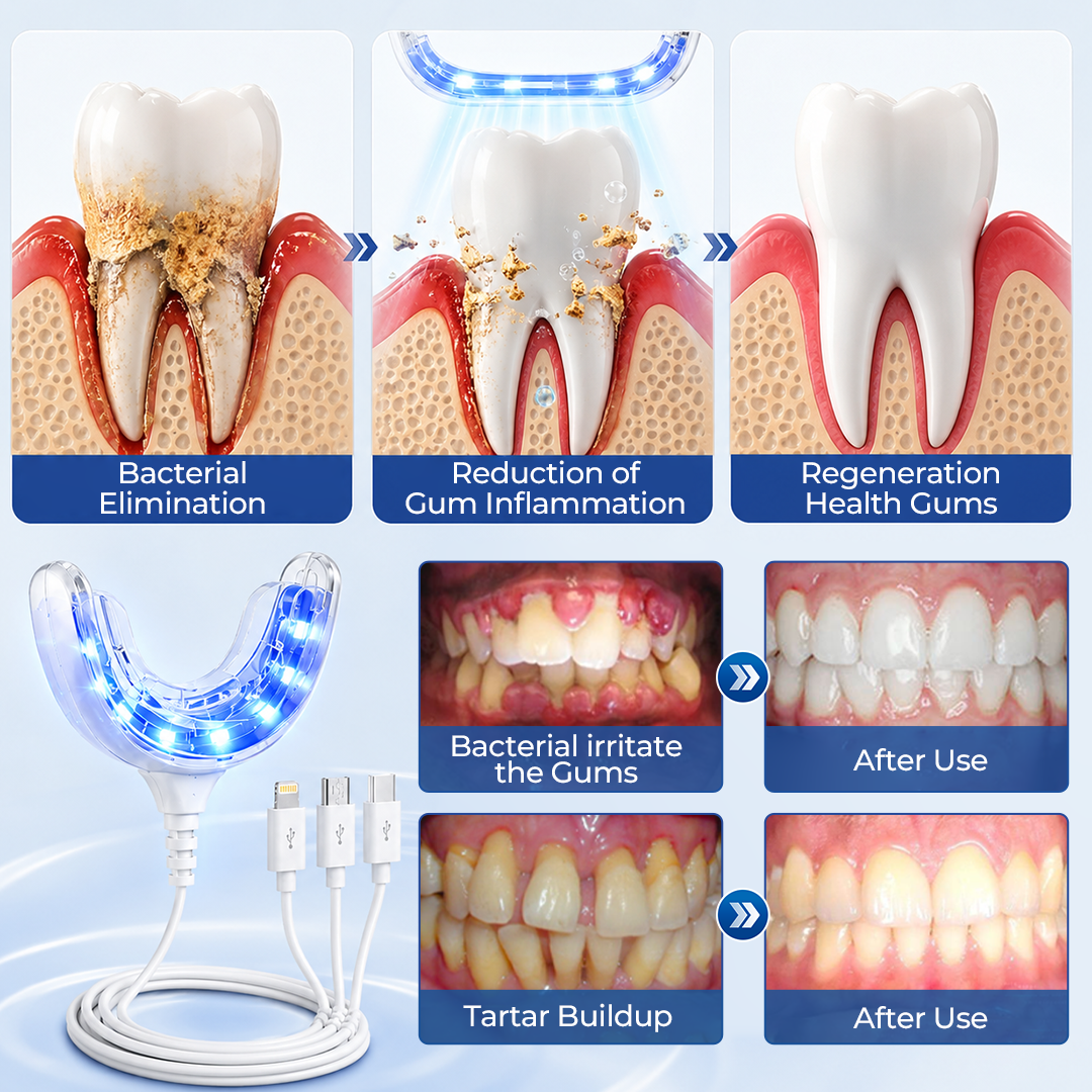 Mresio® RegenDent Advanced Tooth & Gum Renewal Device