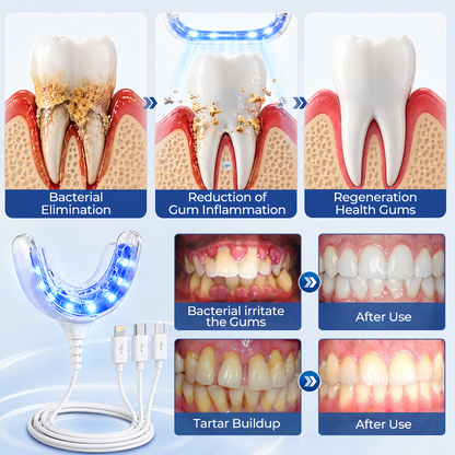 Mresio® RegenDent Advanced Tooth & Gum Renewal Device