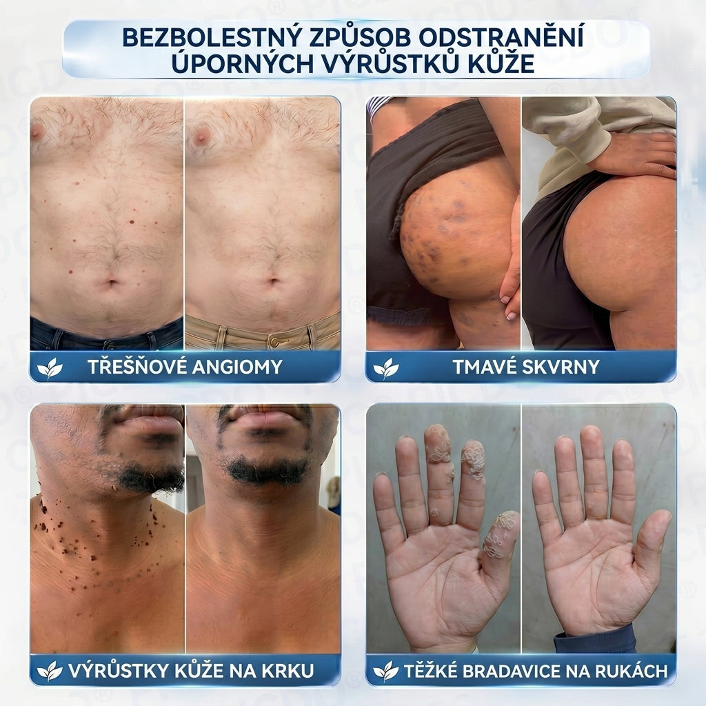 APKAPK® 𝟕𝐝𝐞𝐧𝐧í 𝐤𝐫é𝐦 𝐩𝐫𝐨𝐭𝐢 𝐤𝐨ž𝐧í𝐦 𝐯𝐲𝐫ů𝐬𝐭𝐤ů𝐦 𝐚 𝐩𝐢𝐠𝐦𝐞𝐧𝐭𝐨𝐯ý𝐦 𝐬𝐤𝐯𝐫𝐧á𝐦 (𝐁𝐞𝐳𝐛𝐨𝐥𝐞𝐬𝐭𝐧á 𝐟𝐨𝐫𝐦𝐮𝐥𝐞 – 𝐛𝐞𝐳 𝐣𝐢𝐳𝐞𝐯)
