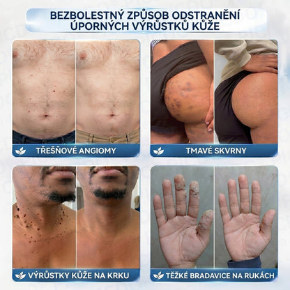 APKAPK® 𝟕𝐝𝐞𝐧𝐧í 𝐤𝐫é𝐦 𝐩𝐫𝐨𝐭𝐢 𝐤𝐨ž𝐧í𝐦 𝐯𝐲𝐫ů𝐬𝐭𝐤ů𝐦 𝐚 𝐩𝐢𝐠𝐦𝐞𝐧𝐭𝐨𝐯ý𝐦 𝐬𝐤𝐯𝐫𝐧á𝐦 (𝐁𝐞𝐳𝐛𝐨𝐥𝐞𝐬𝐭𝐧á 𝐟𝐨𝐫𝐦𝐮𝐥𝐞 – 𝐛𝐞𝐳 𝐣𝐢𝐳𝐞𝐯)