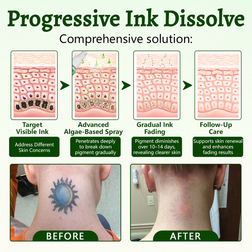 Ceoerty PureAlgae InkRemoval Support SprayB -Say Goodbye to oldTattoo PigmentM,FadeStubborn Ink $, Repair &Smooth Treated Skin-Non-Laser, Try It Now!