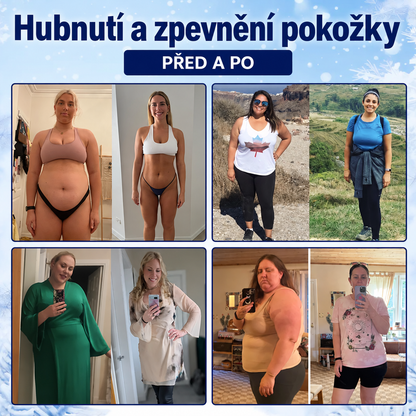 Mirevane CryoContour 4 v 1 – mlha pro tvarování postavy