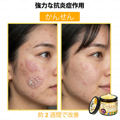 ✨APKAPK® 𝗠É𝗛𝗠É𝗥𝗘𝗚 総合クリーム🥇 皮膚の隆起に対するケアには以下が含まれます： 加齢によるシミ、傷跡、いぼ、皮膚の隆起、脂肪の塊、ニキビ、湿疹、乾癬、反転性ニキビ、しわ、皮膚の老化およびその他の問題🔥