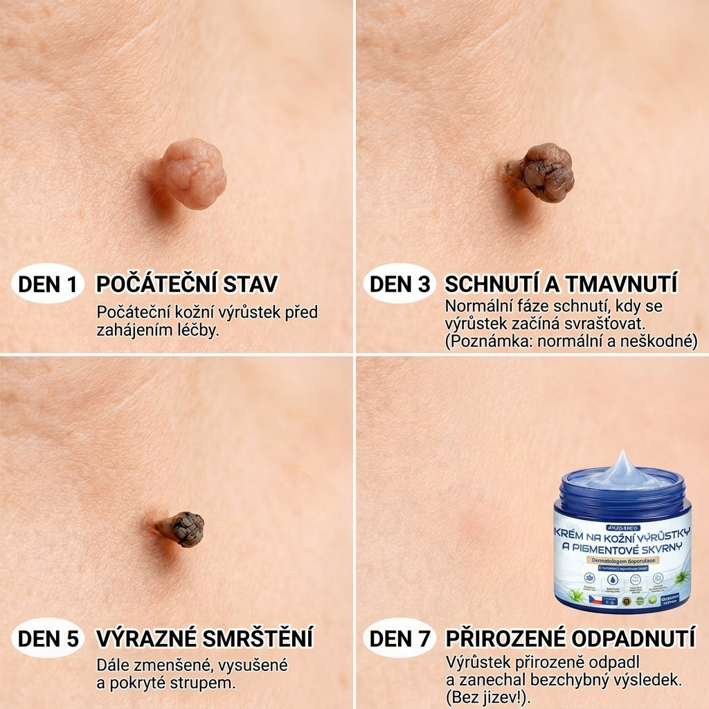 APKAPK® 𝟕𝐝𝐞𝐧𝐧í 𝐤𝐫é𝐦 𝐩𝐫𝐨𝐭𝐢 𝐤𝐨ž𝐧í𝐦 𝐯𝐲𝐫ů𝐬𝐭𝐤ů𝐦 𝐚 𝐩𝐢𝐠𝐦𝐞𝐧𝐭𝐨𝐯ý𝐦 𝐬𝐤𝐯𝐫𝐧á𝐦 (𝐁𝐞𝐳𝐛𝐨𝐥𝐞𝐬𝐭𝐧á 𝐟𝐨𝐫𝐦𝐮𝐥𝐞 – 𝐛𝐞𝐳 𝐣𝐢𝐳𝐞𝐯)