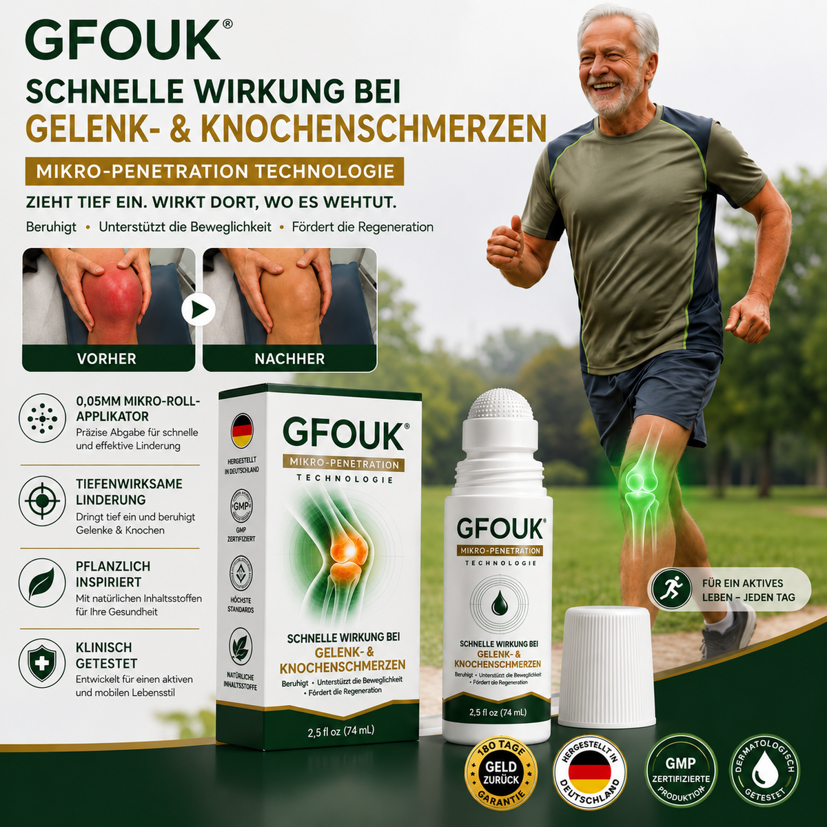 GFOUK® 0,05 mm-es mikrotűs görgő ízület- és csontápoláshoz – 1. termékkép