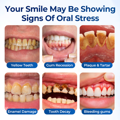 Mresio® RegenDent Advanced Tooth & Gum Renewal Device