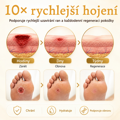 Ceoerty®🍇 DermaVeil ochranný sprej na nohy🍬