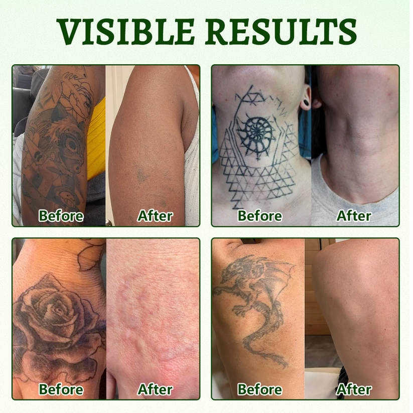Ceoerty PureAlgae InkRemoval Support SprayB -Say Goodbye to oldTattoo PigmentM,FadeStubborn Ink $, Repair &Smooth Treated Skin-Non-Laser, Try It Now!