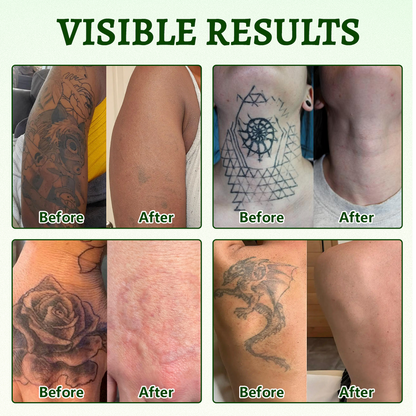 Ceoerty PureAlgae InkRemoval Support SprayB -Say Goodbye to oldTattoo PigmentM,FadeStubborn Ink $, Repair &Smooth Treated Skin-Non-Laser, Try It Now!