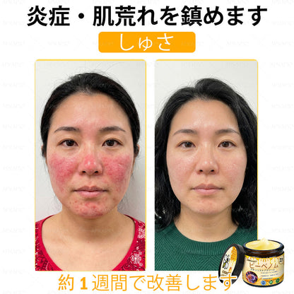 ✨APKAPK® 𝗠É𝗛𝗠É𝗥𝗘𝗚 総合クリーム🥇 皮膚の隆起に対するケアには以下が含まれます： 加齢によるシミ、傷跡、いぼ、皮膚の隆起、脂肪の塊、ニキビ、湿疹、乾癬、反転性ニキビ、しわ、皮膚の老化およびその他の問題🔥