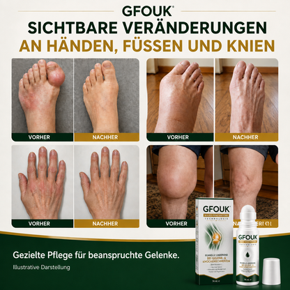 GFOUK® 0,05 mm-es mikrotűs görgő ízület- és csontápoláshoz – 3. termékkép