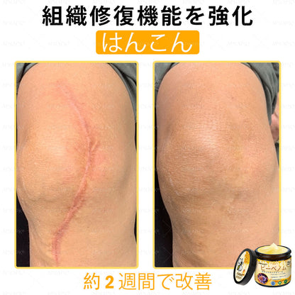 ✨APKAPK® 𝗠É𝗛𝗠É𝗥𝗘𝗚 総合クリーム🥇 皮膚の隆起に対するケアには以下が含まれます： 加齢によるシミ、傷跡、いぼ、皮膚の隆起、脂肪の塊、ニキビ、湿疹、乾癬、反転性ニキビ、しわ、皮膚の老化およびその他の問題🔥