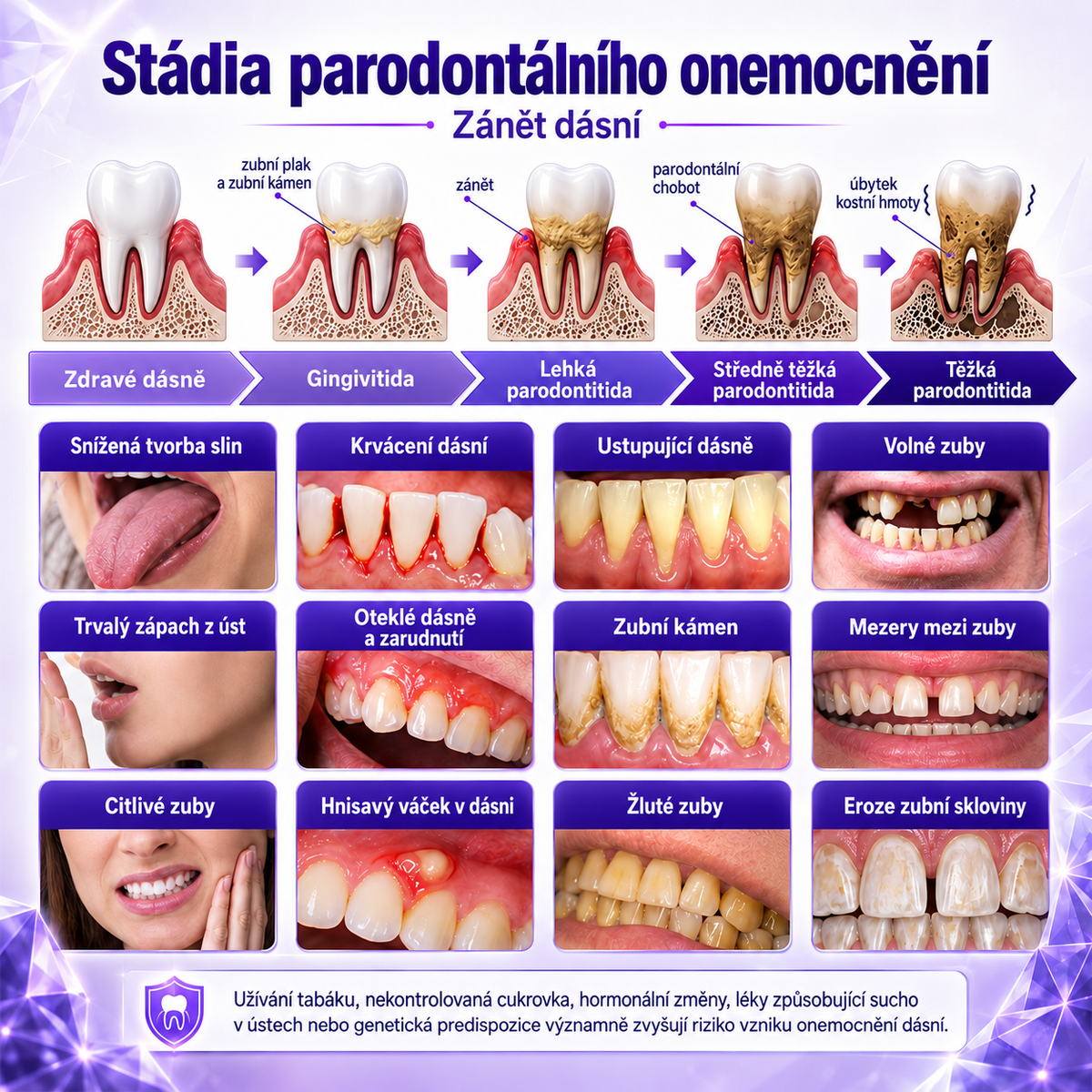 Zubní pasta Ceoerty®🦷 pro léčbu zánětu dásní a parodontu👩🏻‍⚕️