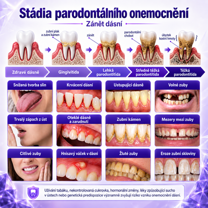 Zubní pasta Ceoerty®🦷 pro léčbu zánětu dásní a parodontu👩🏻‍⚕️