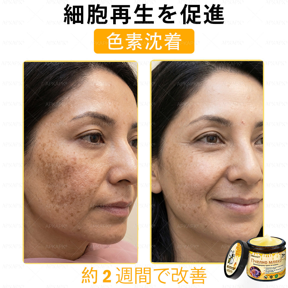 ✨APKAPK® 𝗠É𝗛𝗠É𝗥𝗘𝗚 総合クリーム🥇 皮膚の隆起に対するケアには以下が含まれます： 加齢によるシミ、傷跡、いぼ、皮膚の隆起、脂肪の塊、ニキビ、湿疹、乾癬、反転性ニキビ、しわ、皮膚の老化およびその他の問題🔥
