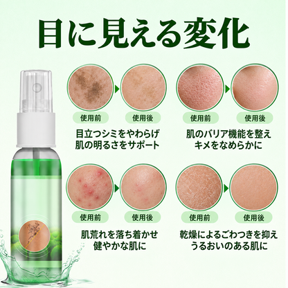 Micdtry® PureAlgae タトゥー除去サポートスプレーB - 古いタトゥーの色素にさよなら、頑固なインクを薄くし、施術後の肌を修復・滑らかに - レーザー不要、今すぐお試しください！✨